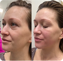 About Sculptiko Beauty | Daria Licensed Esthetician - sculptikobeauty Treat yourself with the rejuvenating experience and get expert facial massage, face sculpt massage and regular beauty massage in Westminster Co. -