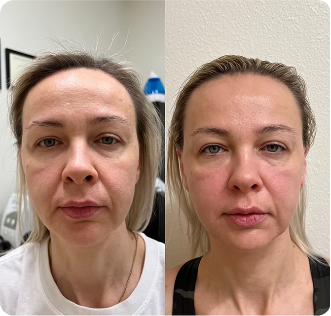 Discover expert Facial Massage Courses near you. Join our Face Massage Class for top-notch Facial Training. Explore our Facial Training Courses today! -