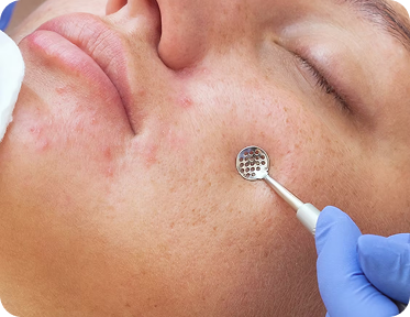 Facial Services | Sculptiko Beauty - sculptikobeauty Facial treatments at Sculptiko Beauty including face sculpting massage, buccal massage, extractions, advanced facials, and chemical peels tailored to your skin. -