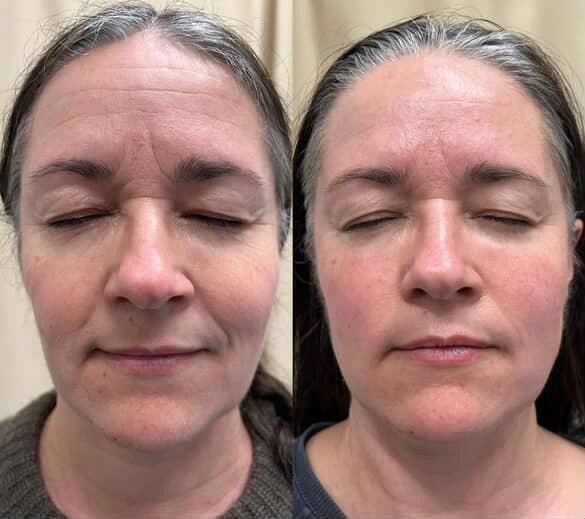 Discover expert Facial Massage Courses near you. Join our Face Massage Class for top-notch Facial Training. Explore our Facial Training Courses today! -