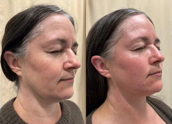 Discover expert Facial Massage Courses near you. Join our Face Massage Class for top-notch Facial Training. Explore our Facial Training Courses today! -