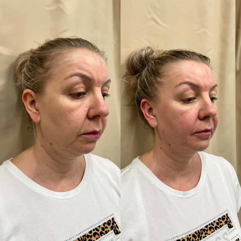 Discover expert Facial Massage Courses near you. Join our Face Massage Class for top-notch Facial Training. Explore our Facial Training Courses today! -