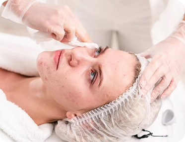 Extractions Facial | Sculptiko Beauty - sculptikobeauty Deep cleansing extractions facial for clogged pores, blackheads, and breakouts. Includes professional exfoliation, serums, masks, and a gentle chemical peel. -